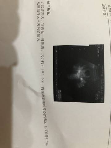 journal_insert_pic_1080483847
