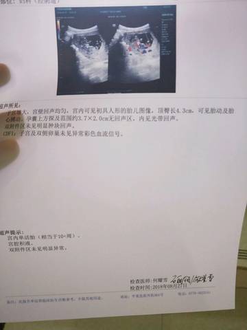 journal_insert_pic_1082235667