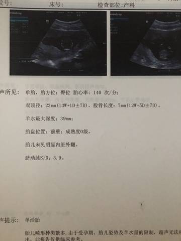 journal_insert_pic_1081967928
