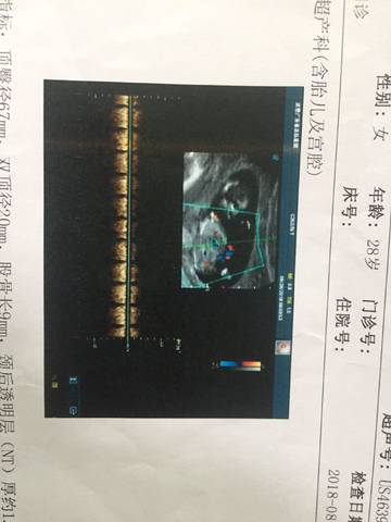 journal_insert_pic_1082520653