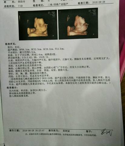 journal_insert_pic_1084252542