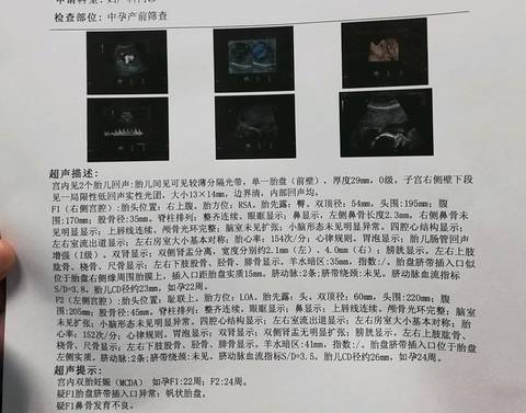 journal_insert_pic_1095603165