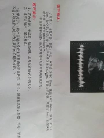 journal_insert_pic_1096170157