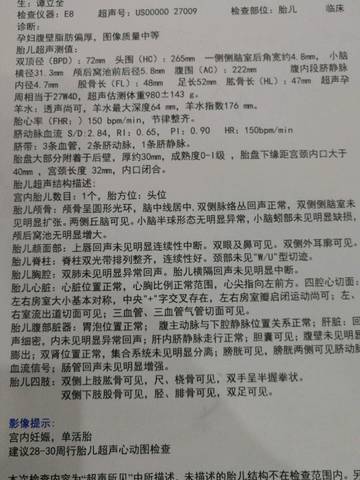 journal_insert_pic_1096480649