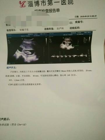 journal_insert_pic_1096334848