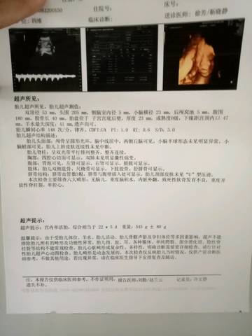 journal_insert_pic_1096121757