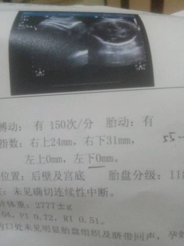 journal_insert_pic_1097082763