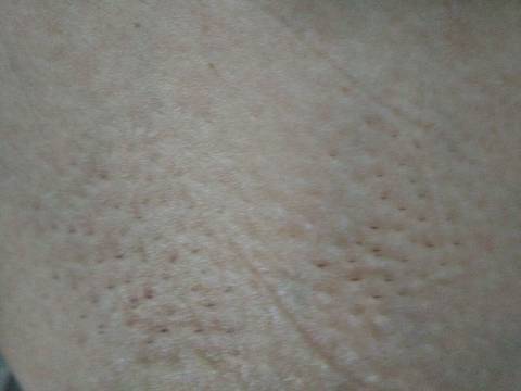 journal_insert_pic_1096795440