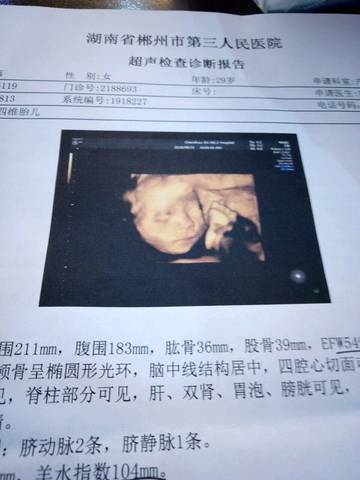 journal_insert_pic_1096764440