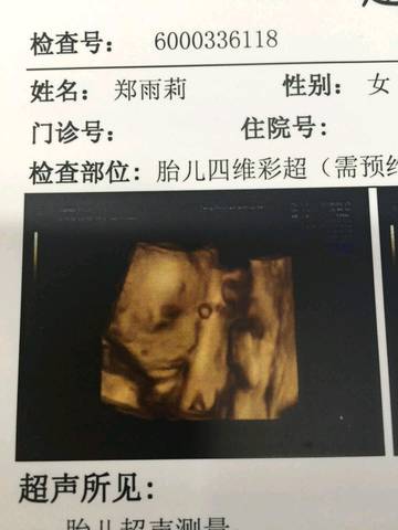 journal_insert_pic_1097105858