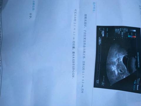journal_insert_pic_1097791774