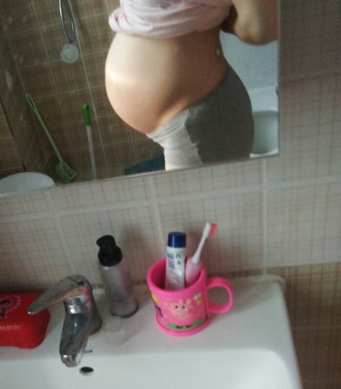 双胎四维顺利通过