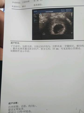journal_insert_pic_1099677686