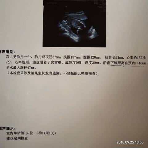 journal_insert_pic_1100248863