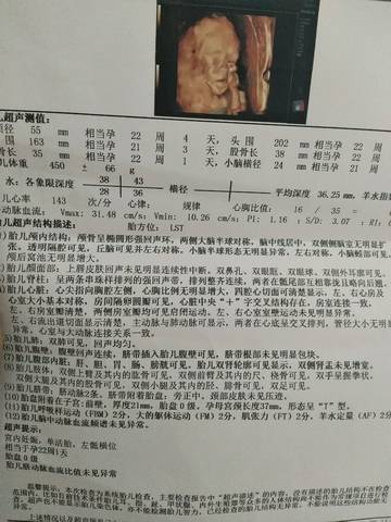 journal_insert_pic_1101305269