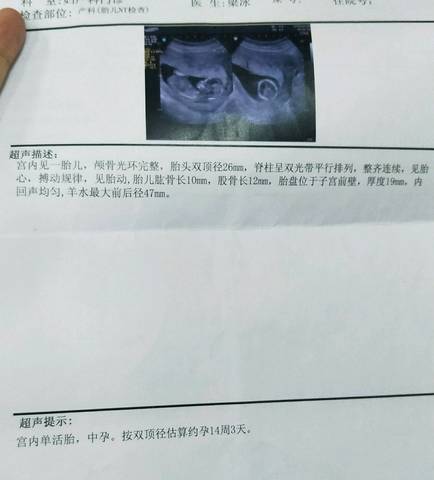 journal_insert_pic_1100827375