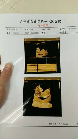 journal_insert_pic_1102333337