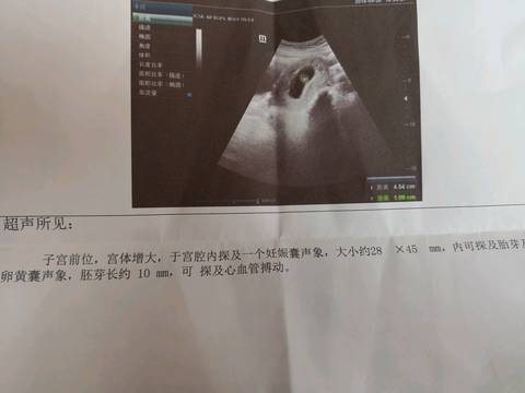 journal_insert_pic_1102071096