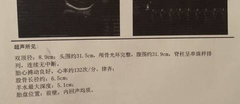 journal_insert_pic_1103320541