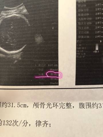 journal_insert_pic_1103320529