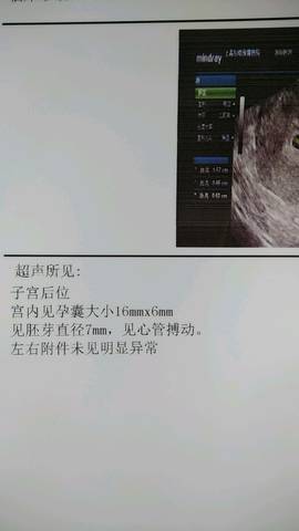 journal_insert_pic_1103933373