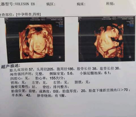 journal_insert_pic_1105207412