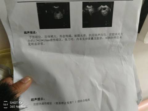 journal_insert_pic_1107783684