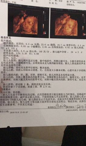 journal_insert_pic_1108554964