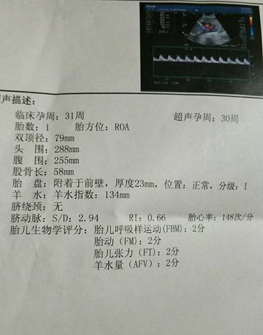 journal_insert_pic_1108422910
