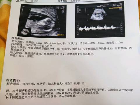 journal_insert_pic_1109189566