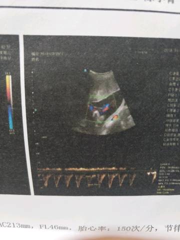 journal_insert_pic_1109266077