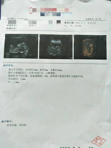 journal_insert_pic_1109790663