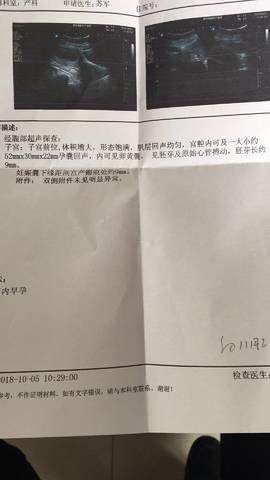 journal_insert_pic_1109671254