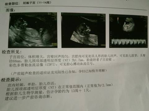 journal_insert_pic_1110242983