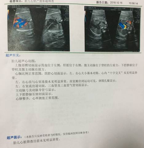 journal_insert_pic_1112154708