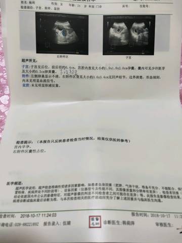 journal_insert_pic_1113621465