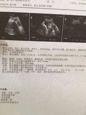 journal_insert_pic_1113487487