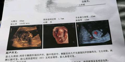 journal_insert_pic_1114136107