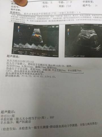 journal_insert_pic_1114703856