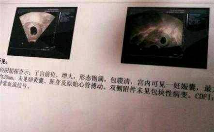 journal_insert_pic_1115065870