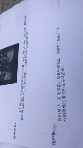 journal_insert_pic_1115859315