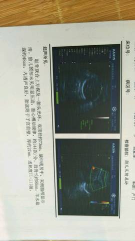 journal_insert_pic_1116844653
