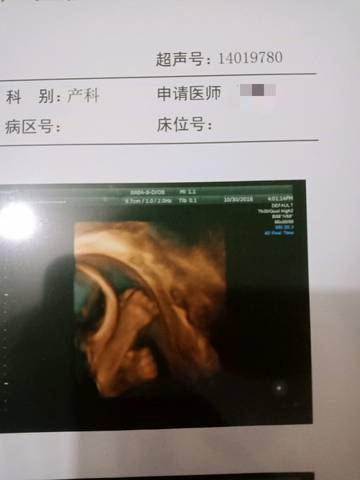 journal_insert_pic_1121169042