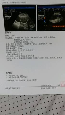 journal_insert_pic_1124611489