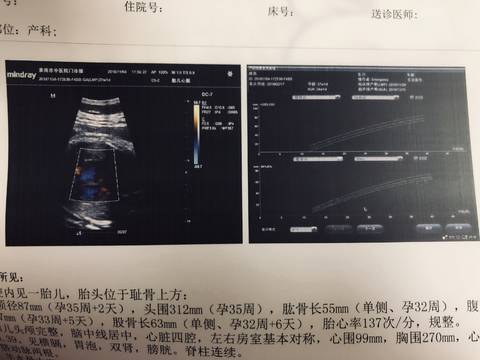 journal_insert_pic_1125589190