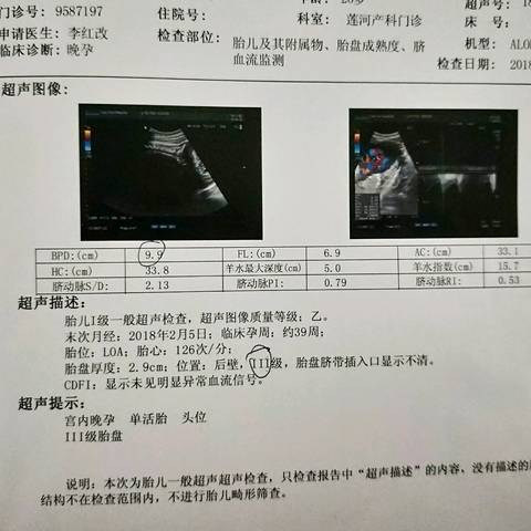 journal_insert_pic_1126317289