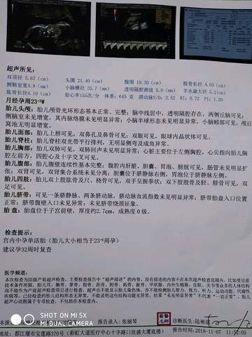 journal_insert_pic_1126745328