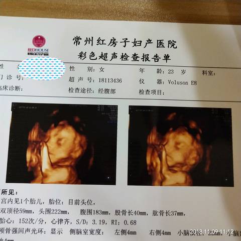 journal_insert_pic_1127133054