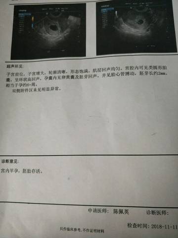 journal_insert_pic_1127607394