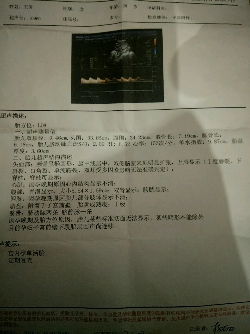 37周了胃泡又大